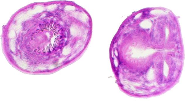 [Translate to Romanian:] Echinokokkose